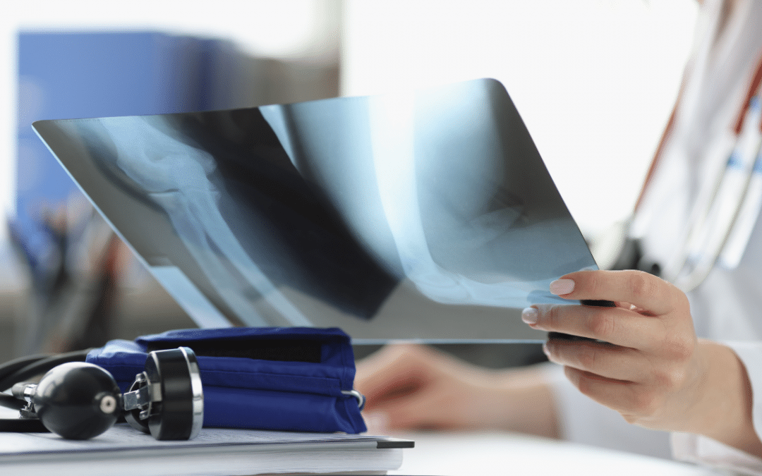 How Can Different Types of Contrast Agents Impact X-Ray Diagnostic Accuracy?