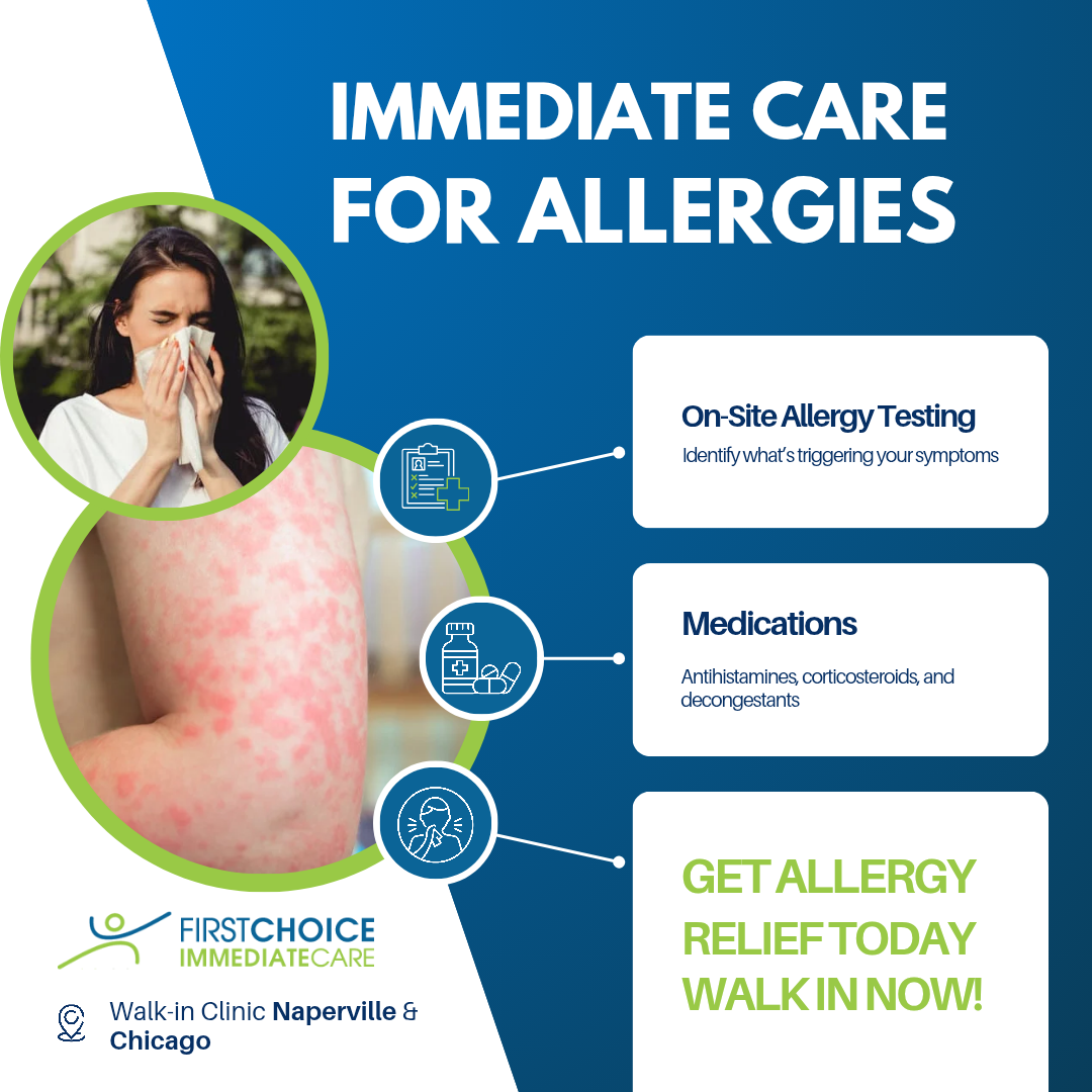 Allergies Treatment In Chicago &Amp; Naperville Allergies Treatment in Chicago & Naperville
