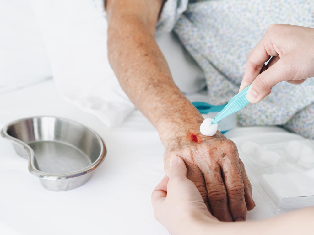 How To Reduce Wound Swelling In Chicago? 1 Keep the Wound Area Clean and Dry