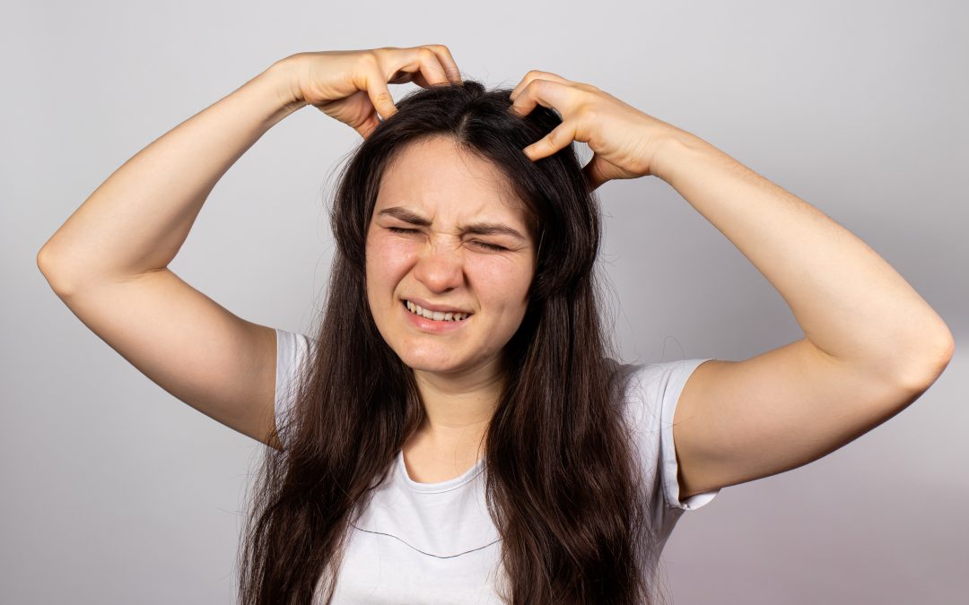 How to Get Rid of Ringworm Permanently?