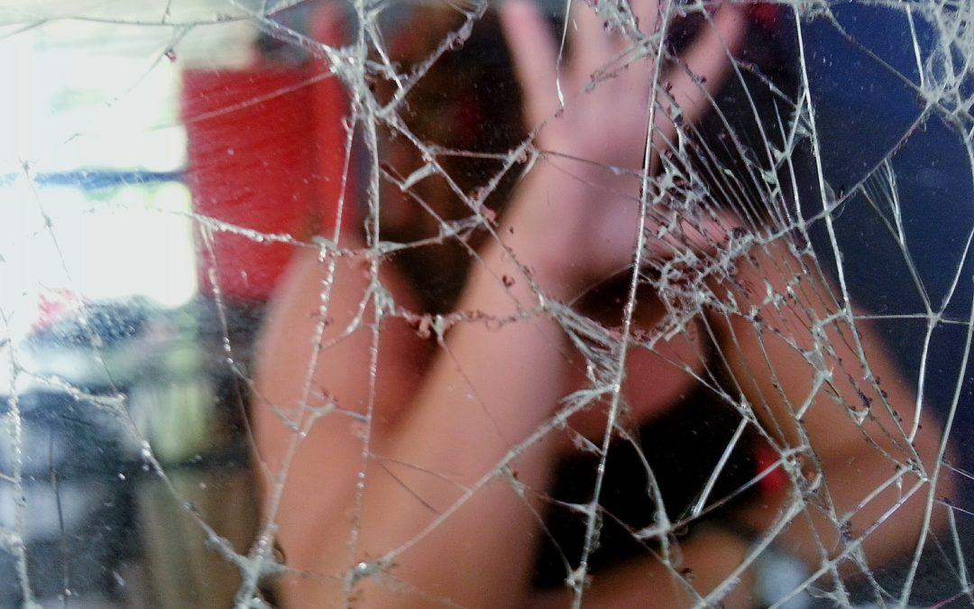 Glass under skin healed over in Chicago