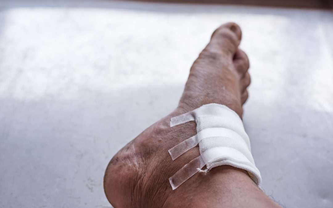 Glass in foot infection symptoms in Naperville