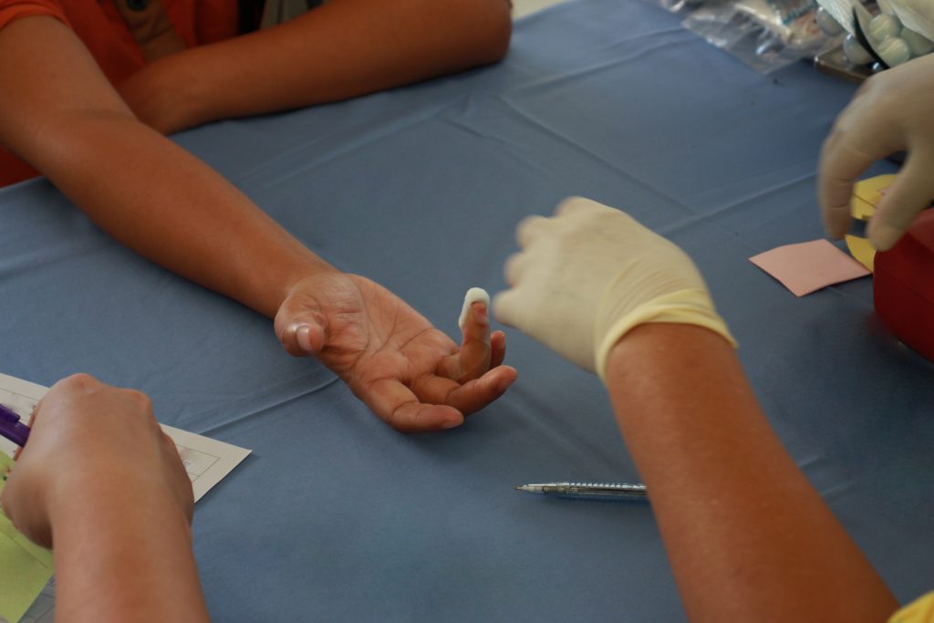 How To Get Rid Of Pencil Stab Mark In Chicago? low angle view mother holding hands table