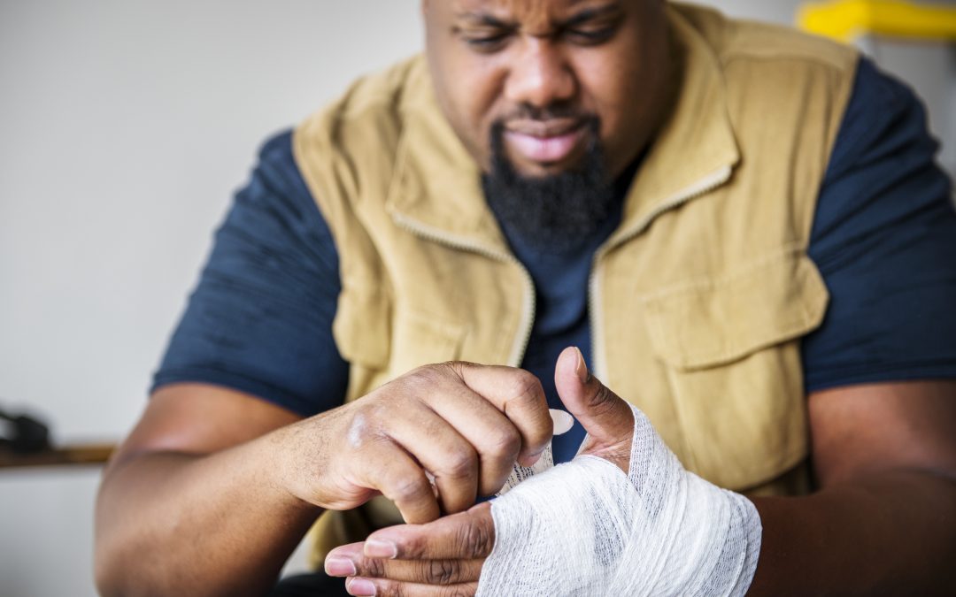 How to remove a splinter without tweezers in Chicago?